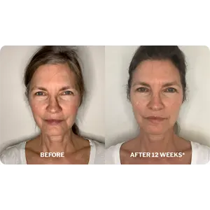 Dermal Repair Complex reviews before and after