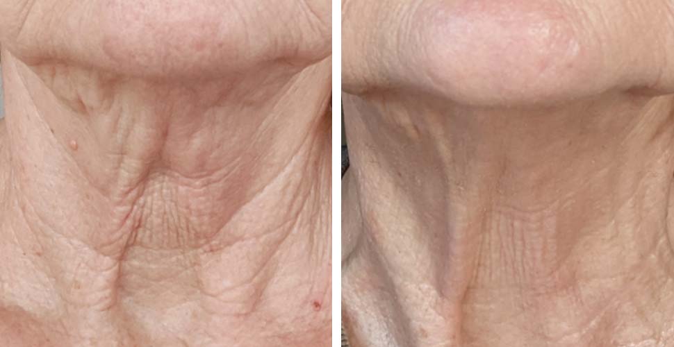 InvisiCrepe Body Balm Before and After